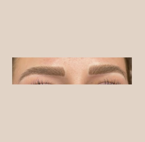 Browlift - Duré : 45mins